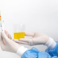 Urine Tests: Overview and Benefits