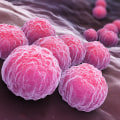 Chlamydia Treatment: A Comprehensive Overview