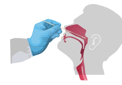 Understanding Swab Tests