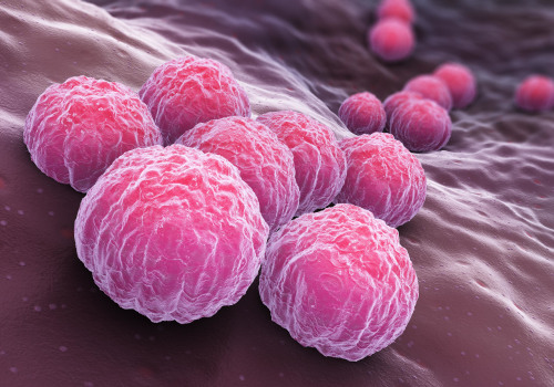 Chlamydia Infection: Everything You Need to Know