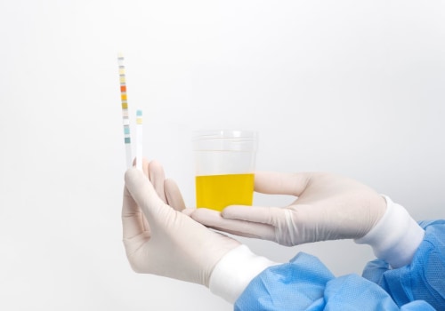 Urine Tests: Overview and Benefits